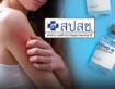 ไขข้อสงสัย “แพ้วัคซีนโควิด-19” ตั้งแต่ 4 ก.ค. 65 ได้รับเยียวยาหรือไม่